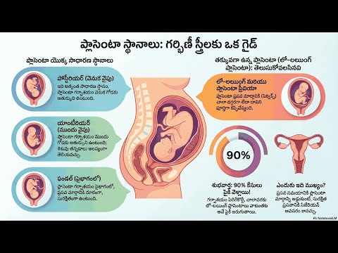 Placental Location — video thumbnail