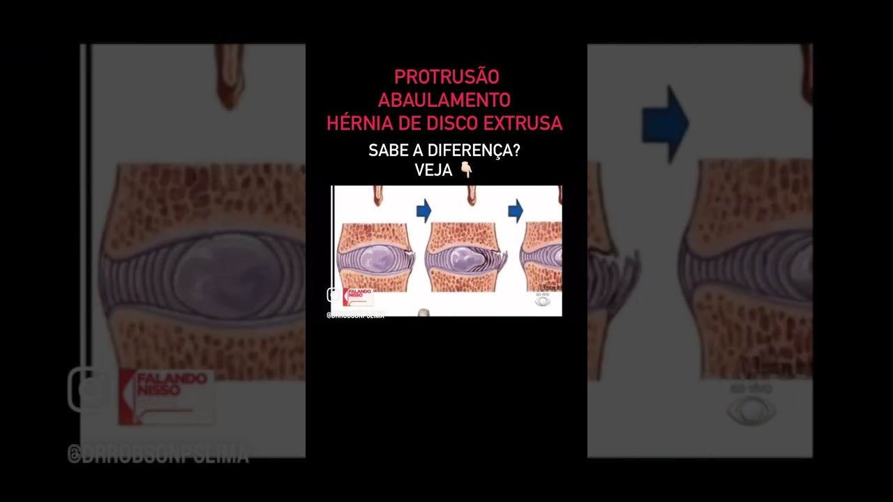Robson Prudêncio Silva Lima-113