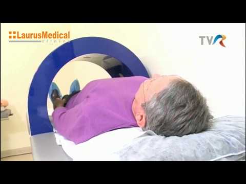 Osteoporoza