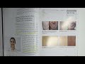 Milady Esthetics Chapter 5 Pages 163 171 Skin Analysis Esthetician Aesthetician