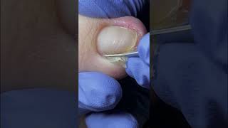 Download lagu Cute nails satisfying pedicure #nails#satisfying#pedicure mp3 Download lagu Cute nails satisfying pedicure #nails#satisfying#pedicure mp3