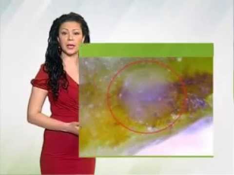 Zelena prognoza 29.4.2015. - O stanju u zasadima vinove loze