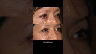 Nava Face & Eye