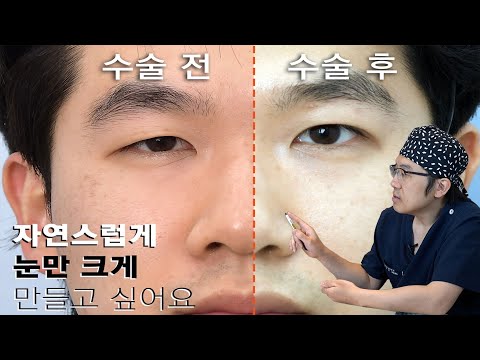 男性眼部 03