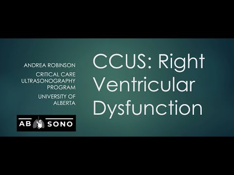 Right ventricular dysfunction