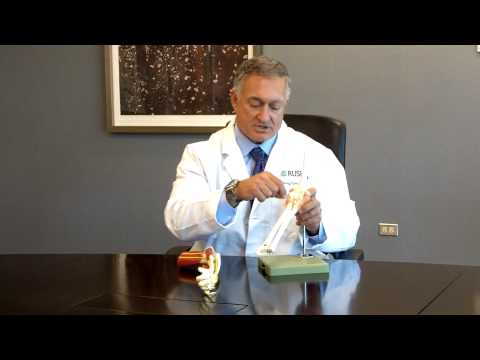 Distal Biceps Tendon Surgery