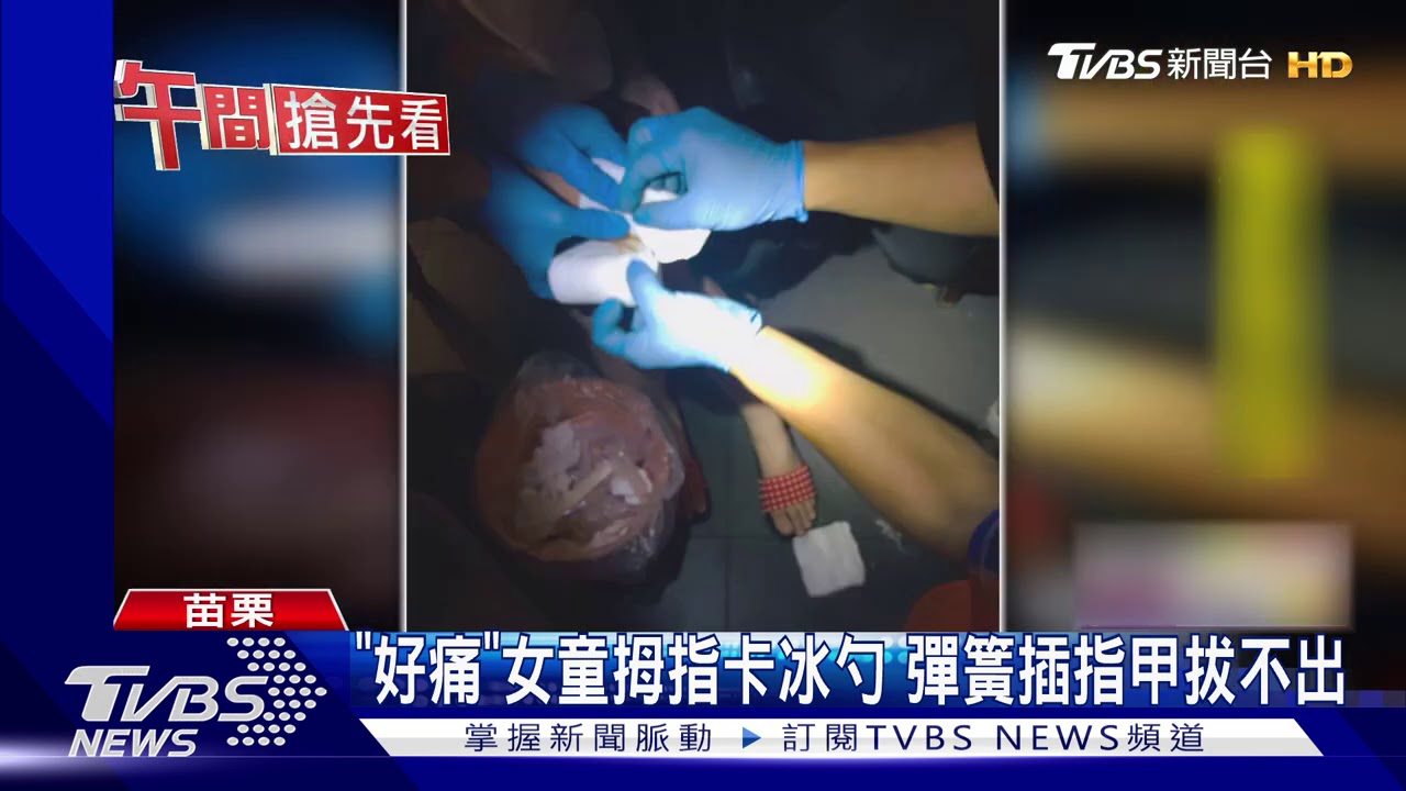 「好痛」女童拇指卡冰勺 彈簧插指甲拔不出