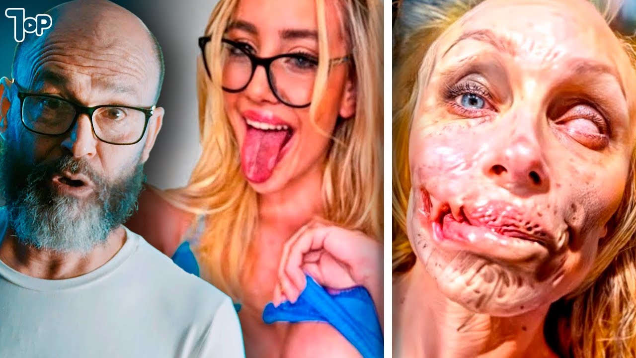 20 CIRURGIAS PLÁSTICAS QUE DERAM ERRADAS