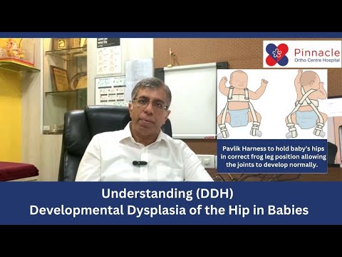 Understanding (DDH) Developmental Dysplasia of Hip in Babies | Dr Sandeep Vaidya | Pinnacle Hospital