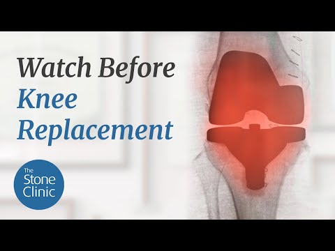You Likely Don't Need A Knee Replacement (80% Don't)