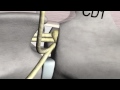 Bovine Procedures 03 Bovine Caudal Epidural Anesthesia