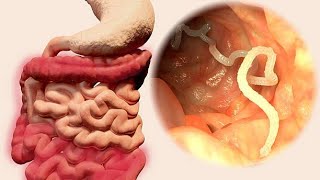 Nematode Navigations: A Dive into Gastrointestinal Parasites (4 Minutes)