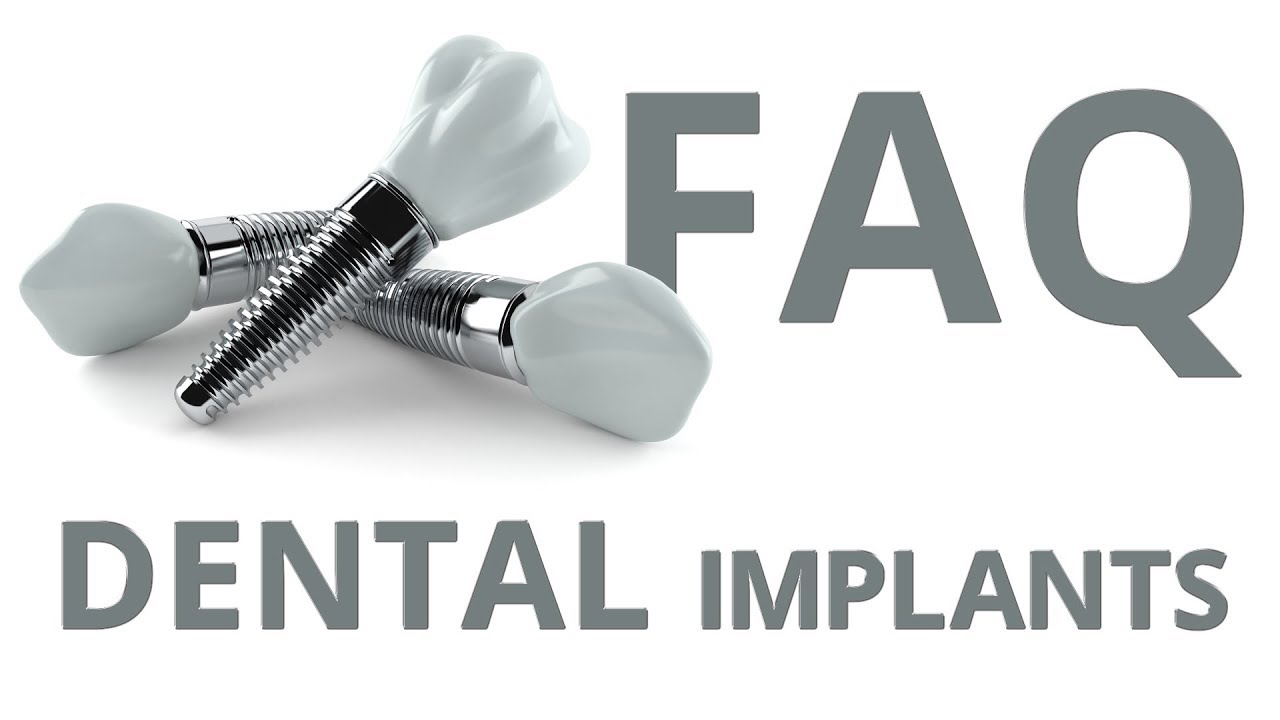 Frequently asked questions about dental implants