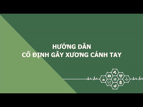 Hướng dẫn cố định gẫy xương cánh tay