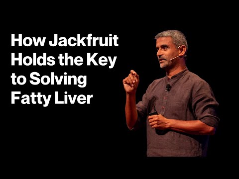 A simple solution to treat your fatty liver | James Joseph | TEDxGateway