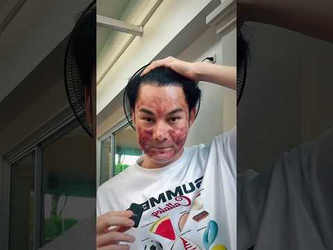 อายุน้อยร้อยเข็ม