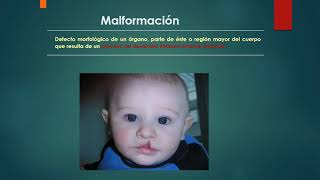 Anomalias Congénitas - Parte 1