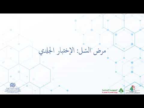 Video 14