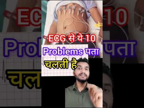 ECG