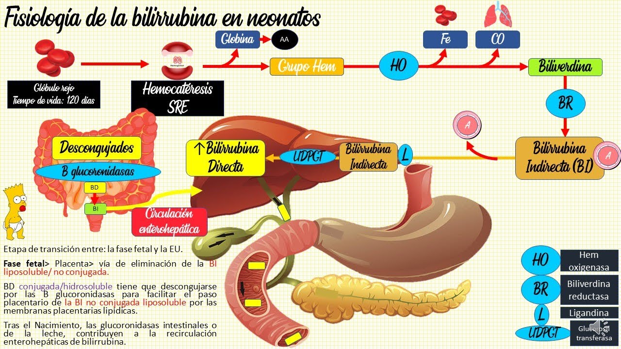 Ictericia neonatal: Fisiológica y patológica👶 PEDIATRÍA