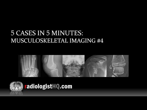 5 Cases in 5 Minutes: Musculoskeletal #4