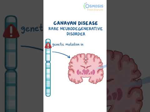 Diagnostics on Demand Cardiac tamponade