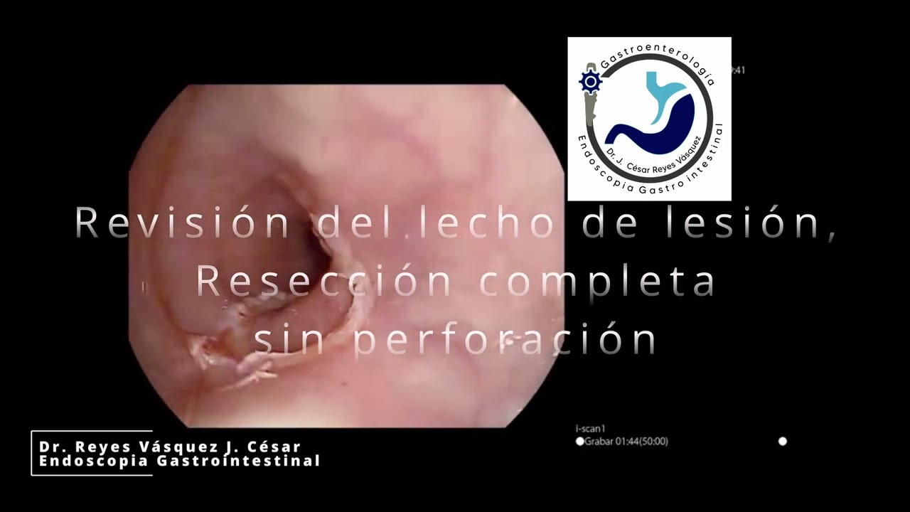 J. César Reyes Vásquez-37