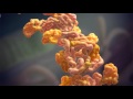 What Is AL Amyloidosis