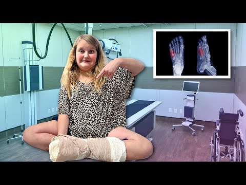 Did PARKER Break her FOOT?!