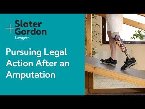 Pursuing Legal Action After an Amputation