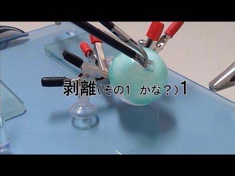 アナ・ポーラ・シーベルトさんはIUDで子宮に穴を開け、手術を受ける