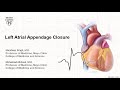 Left Atrial Appendage Closure