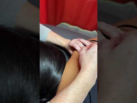 Dry Needling with FCAMPT, Shannon Michels