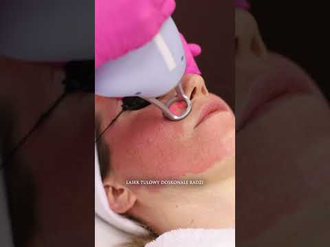 Usuwanie przebarwień i wyrównanie kolorytu w Estell