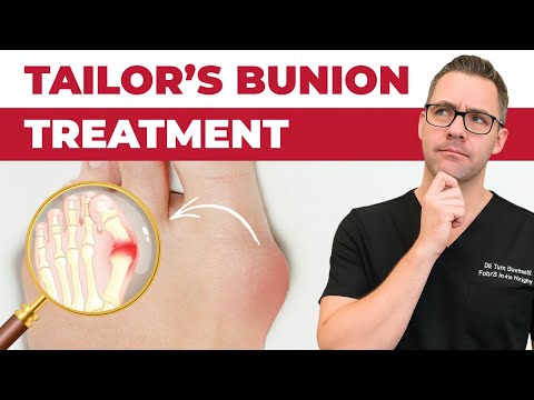 TOP 13 Ways to Shrink Bunions Naturally 1 HUGE SECRET