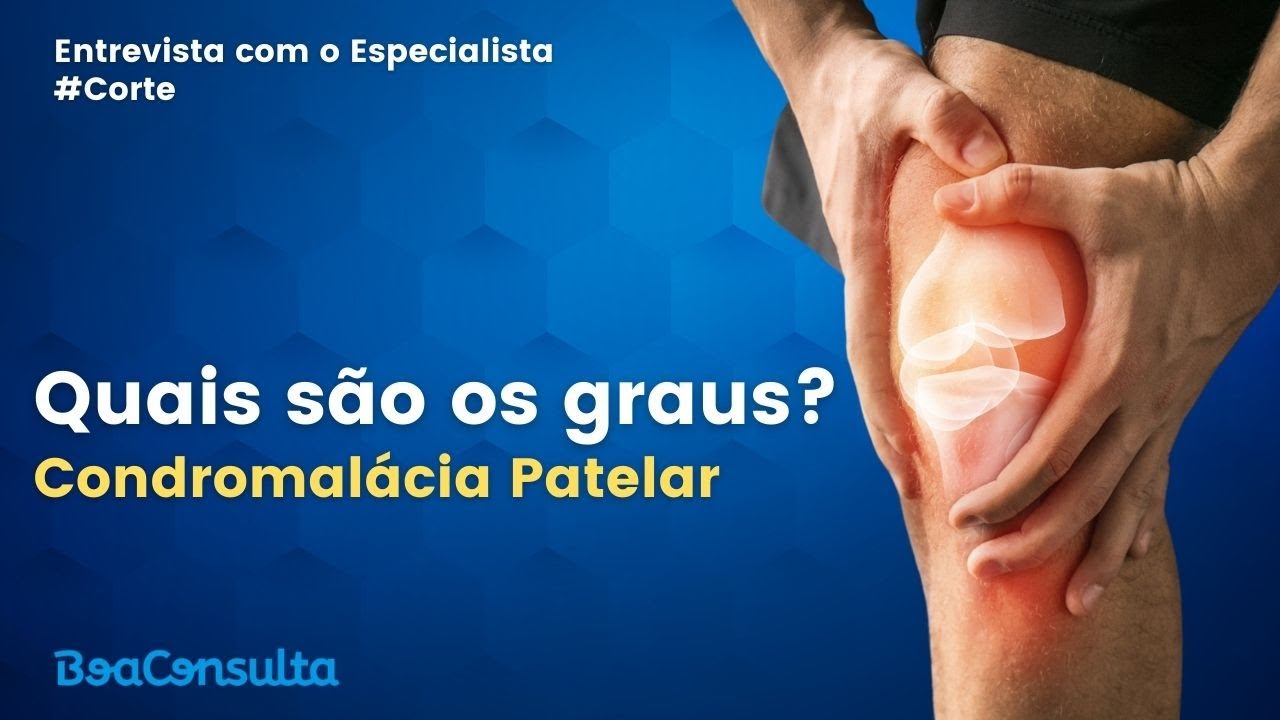 Quais são os graus da Condromalácia patelar? Especialista em joelho explica!