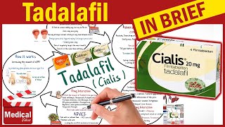 Tadalafil ( Cialis ): What is Tadalafil Used For, Dosage, Side Effects & Precautions
