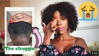 Treating My Horrible Fungal Infection || STORY TIME
