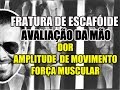 Avaliação de Fratura de Escafóide: Dor, ADM e Força Muscular