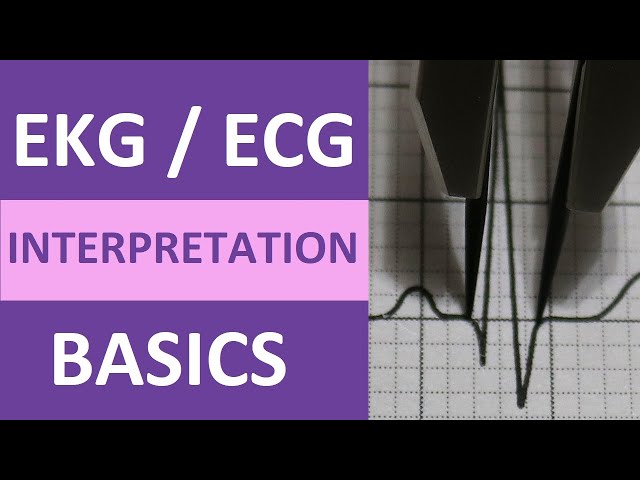Understanding Ekg Box Understanding EKG/ECG Interpretation: A Comprehensive Guide for Nursing ...