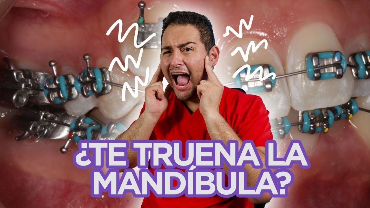 😖 ”ME TRUENA LA MANDÍBULA” 😖 ¡DEBERÍAS VER ESTE VIDEO!😍 (🔥CASO de CHASQUIDOS RESUELTO en 2021🔥)