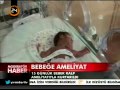 15 Günlük Bebek Kalp Ameliyatıyla Kurtarıldı