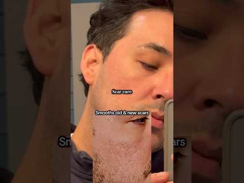 New Silicone Scar Stick with Centella from Prequel Skin 🥰@PrequelSkin