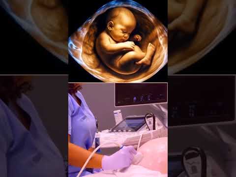 7 months baby movements in mother's womb #weekspregnant #viralvideo #momtobe #thirdtrimester #shorts