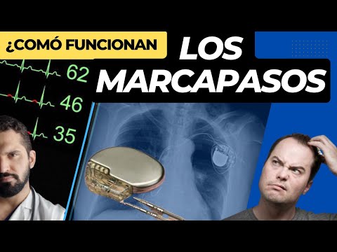 CARDIAC PACEMAKERS. How do they work? Types and indications