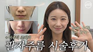 투 턱+ 팔자주름 탈출 👵→👸