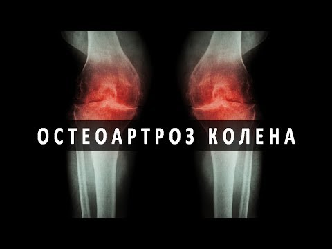 Болят бока в спине при беременности Пунктирование тазобедренного сустава