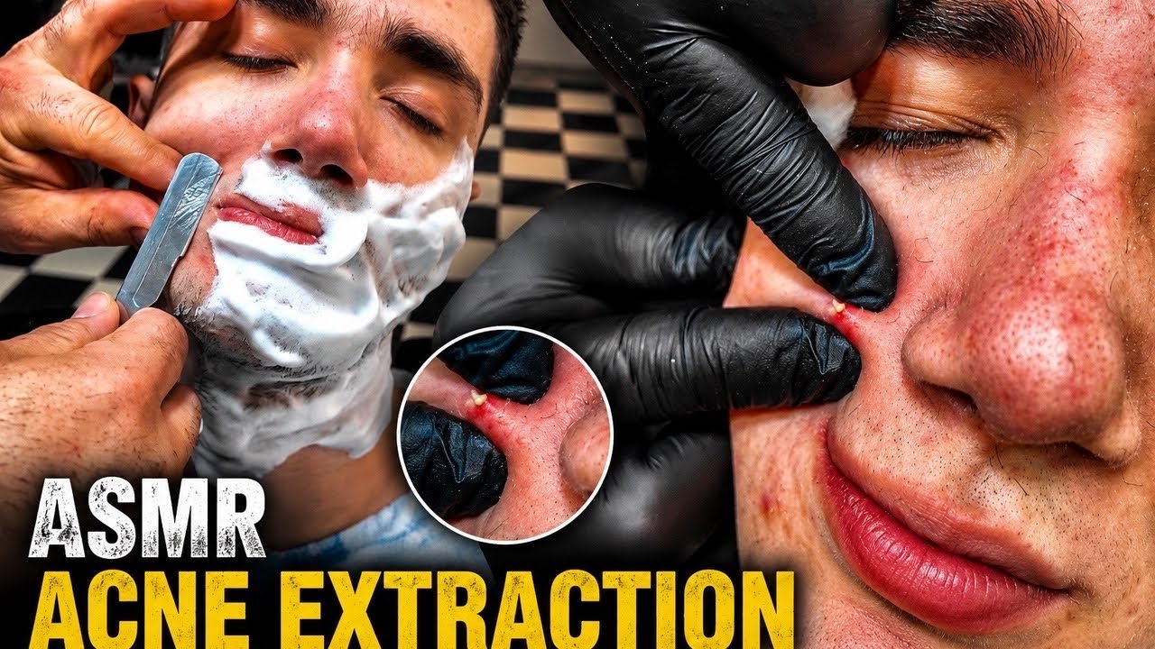 ASMR Beard Shave and Acne Extraction for Deep Sleep