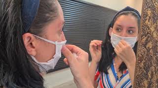 cicatrizes após despigmentação de sobrancelhas alaranjada.