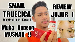 Download lagu REVIEW JUJUR SNAIL TRUECICA SETELAH 8 BULAN PEMAKAIAN | Some By Mi (Indonesia) mp3